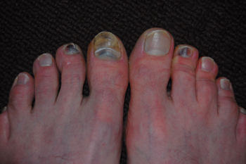 Admittedly, the other toenails don't look so hot either.